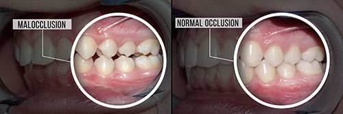 Fasteau Family Dentistry | Extractions, Root Canals and Periodontal Treatment
